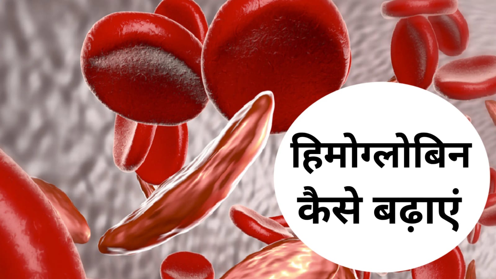 Foods For Hemoglobin