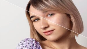 Melanin reducing tips