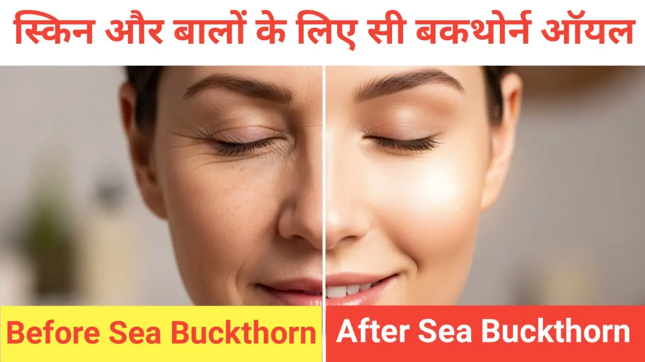 Sea Buckthorn Oil Benefits